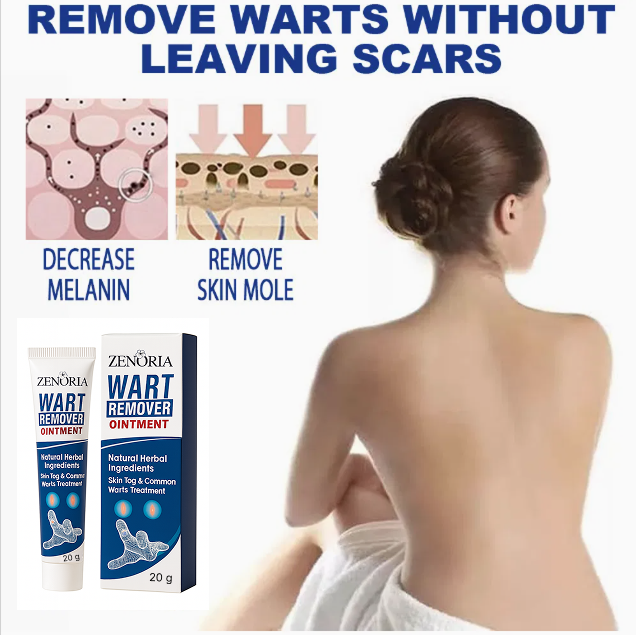 ZENORIA Masť na Odstránenie Bradavíc