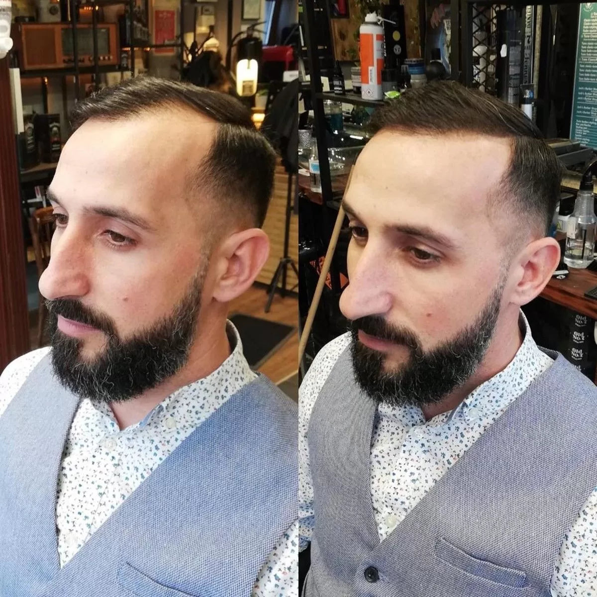 Prášok Na Vlasy Prirodzený Efekt Stimulácie Rastua