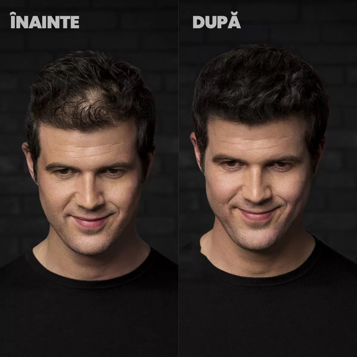 Prášok Na Vlasy Prirodzený Efekt Stimulácie Rastua