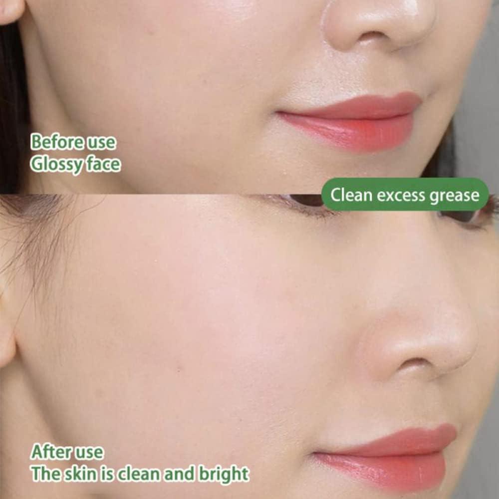 Maska na Čistenie Pórov a Kontrolu Akné 1+1 Zadarmo