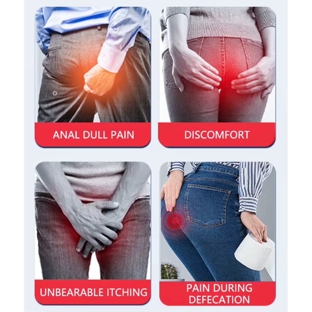 Prírodný Bylinný Krém Na Hemoroidy A Análne Fistuly 1+1 Zadarmo